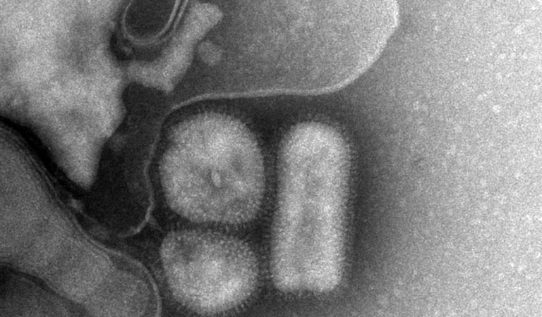 Bild på svininfluensavirus. Foto:Folkhälsomyndigheten